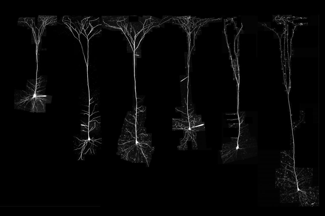 Study finds a striking difference between neurons of humans and other mammals