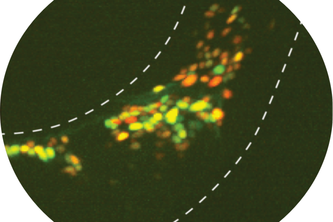 Feast or forage? Study finds circuit that helps a brain decide Feast or forage? Study finds circuit that helps a brain decide