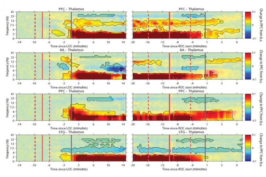 Anesthesia doesn't simply turn off the brain — it changes its rhythms