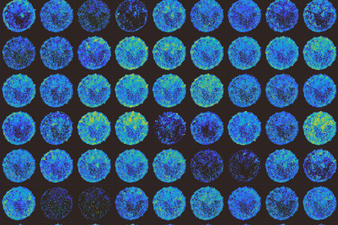 Simons Center’s collaborative approach propels autism research, at MIT and beyond Simons Center’s collaborative approach propels autism research, at MIT and beyond