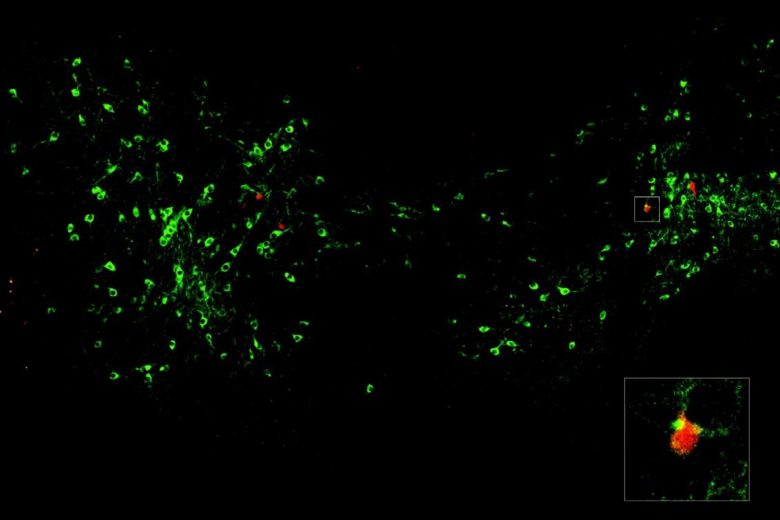 Dopamine signals when a fear can be forgotten Dopamine signals when a fear can be forgotten