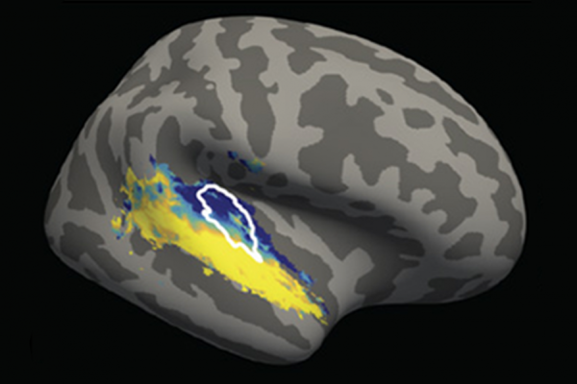 brain-region-sound-background.png brain-region-sound-background.png