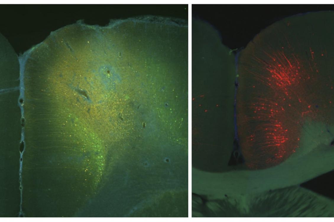 When a task adds more steps, this brain circuit helps you notice