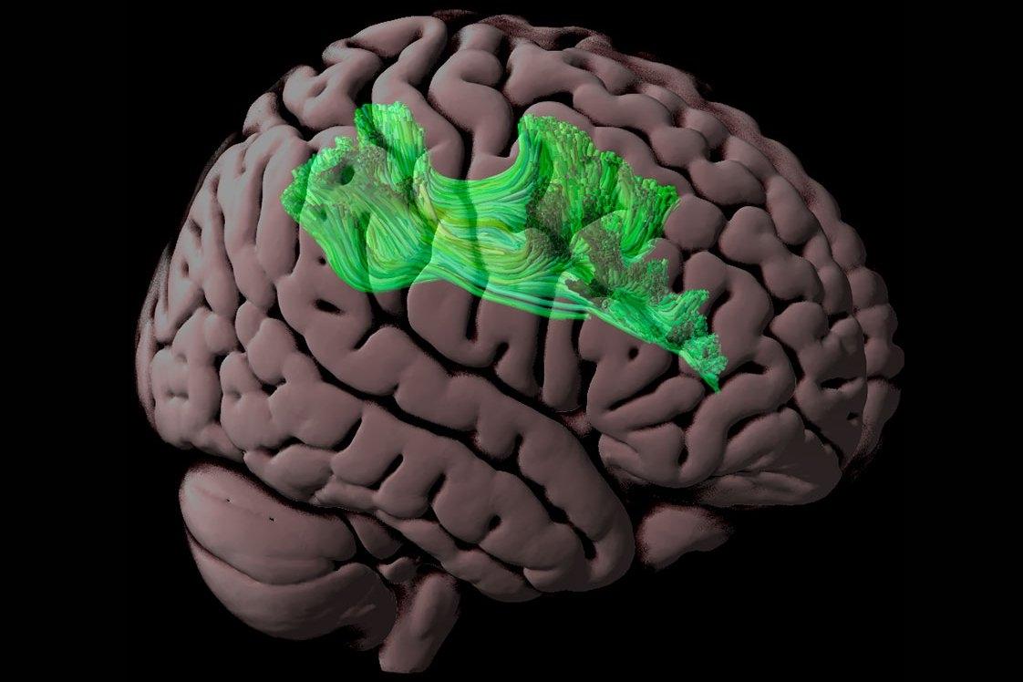 Assessing connections in the brain’s reading network Assessing connections in the brain’s reading network