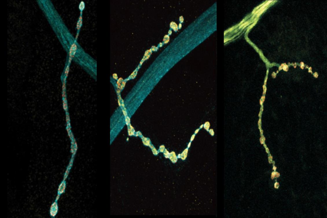 Individual neurons mix multiple RNA edits of key synapse protein, study finds Individual neurons mix multiple RNA edits of key synapse protein, study finds