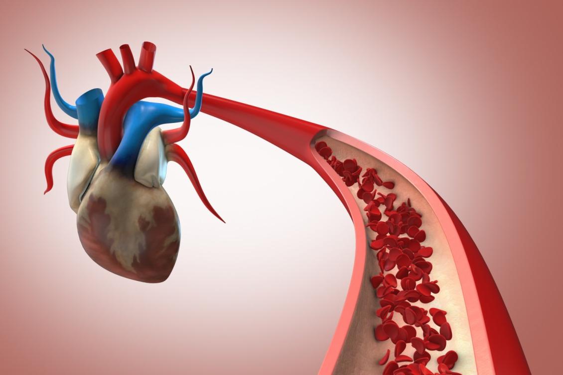 New method enables fast, accurate estimates of cardiovascular state to inform blood pressure management New method enables fast, accurate estimates of cardiovascular state to inform blood pressure management