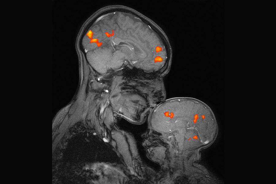 MIT’s McGovern Institute is shaping brain science and improving human lives on a global scale MIT’s McGovern Institute is shaping brain science and improving human lives on a global scale