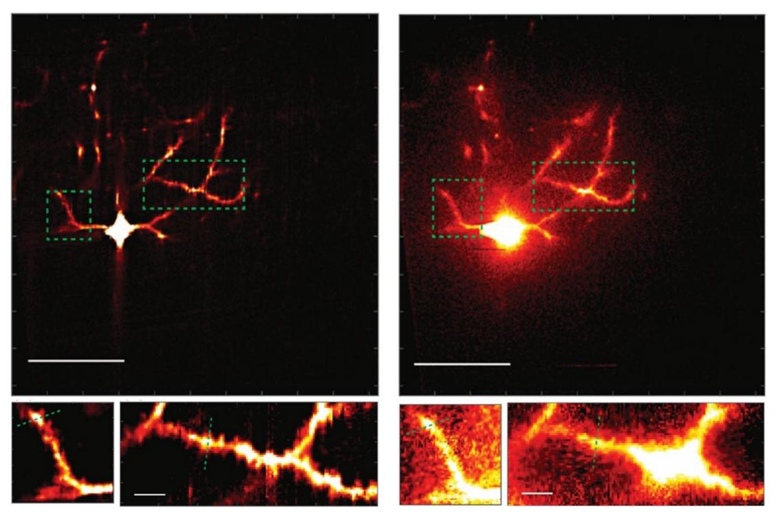 Microscope system sharpens scientists’ view of neural circuit connections