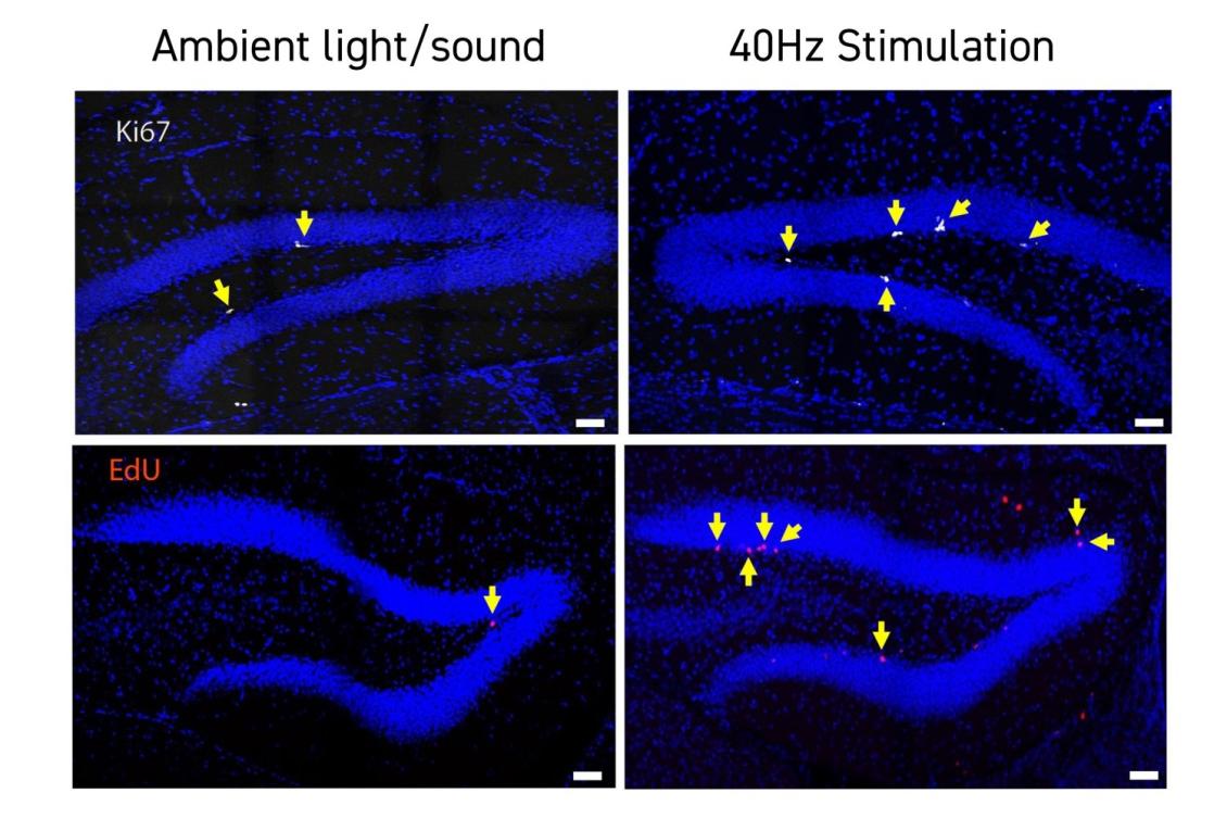 In Down syndrome mice, 40Hz light and sound improve cognition, neurogenesis, connectivity In Down syndrome mice, 40Hz light and sound improve cognition, neurogenesis, connectivity
