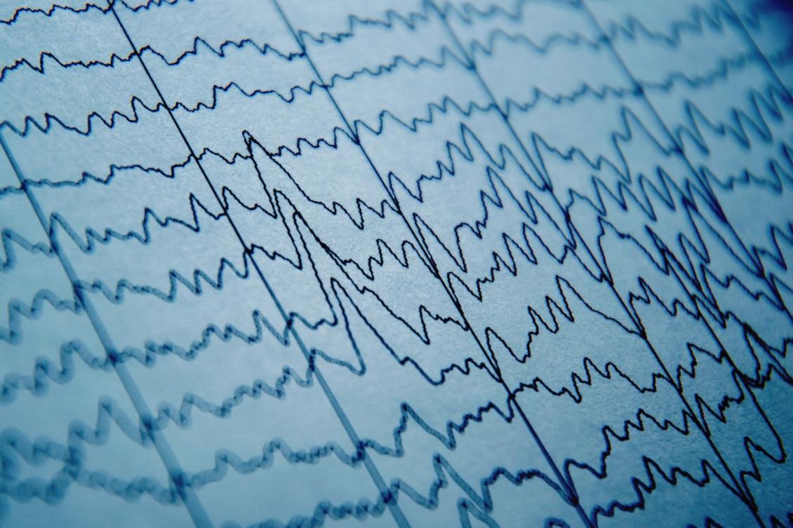 Electric fields help guide neural activity, even from moment to moment