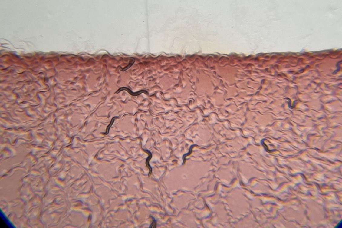 How neurons sense bacteria in the gut