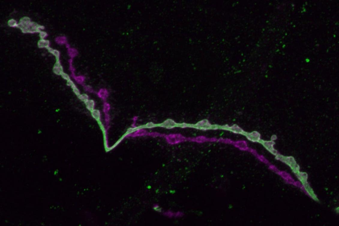 Study connects neural gene expression differences to functional distinctions Study connects neural gene expression differences to functional distinctions