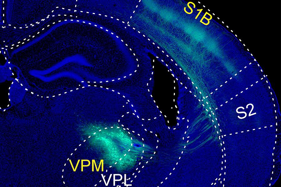 How touch dampens the brain’s response to painful stimuli How touch dampens the brain’s response to painful stimuli