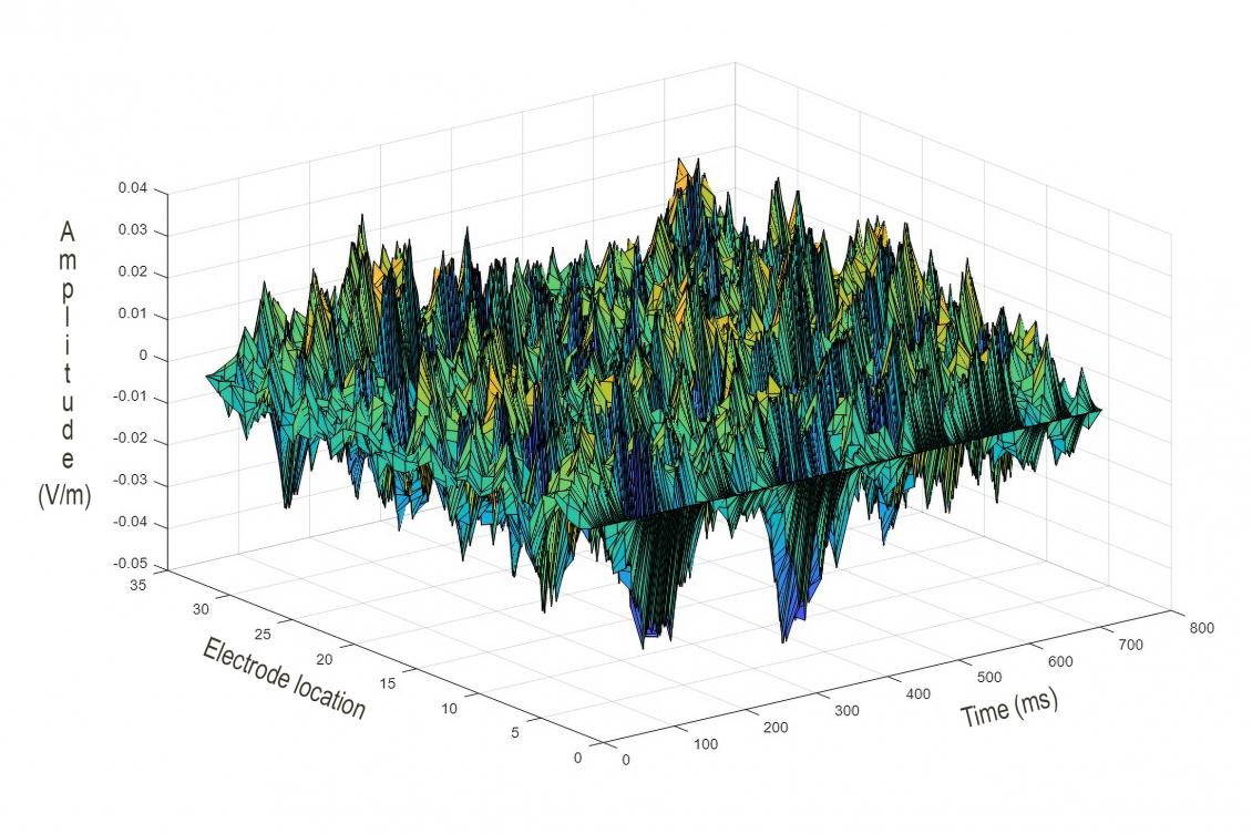 Neurons are fickle. Electric fields are more reliable for information. Neurons are fickle. Electric fields are more reliable for information.