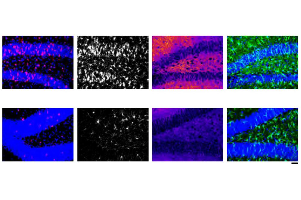 Nanoparticle-delivered RNA reduces neuroinflammation in lab tests